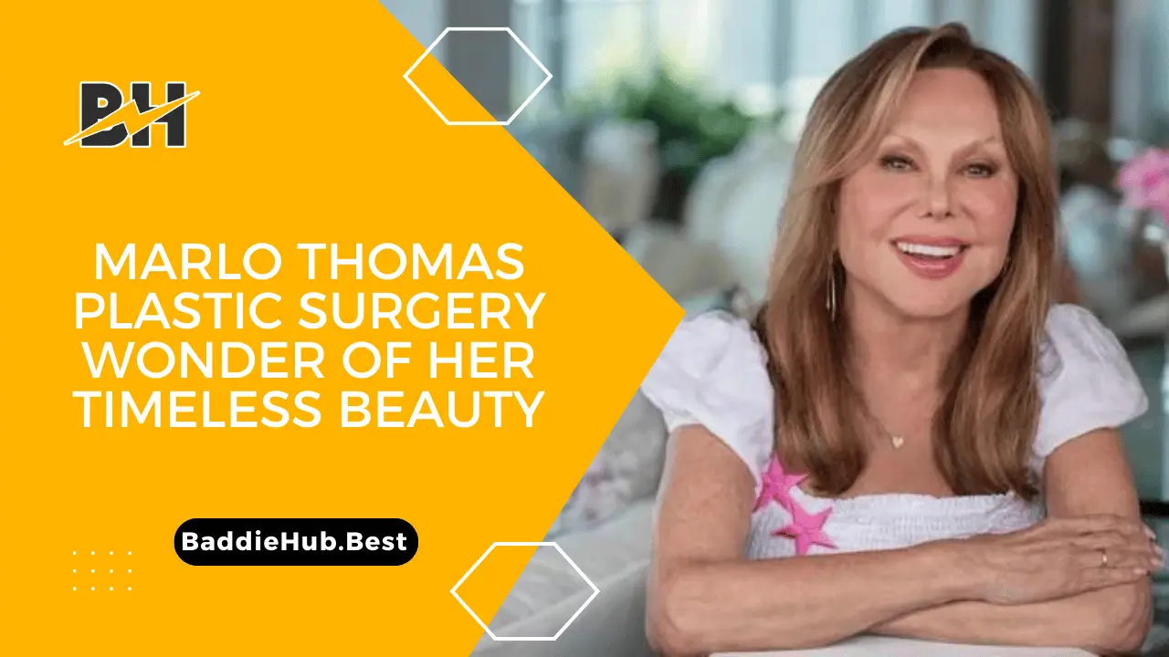 Marlo Thomas, Plastic Surgery, Wonder Of Her Timeless Beauty